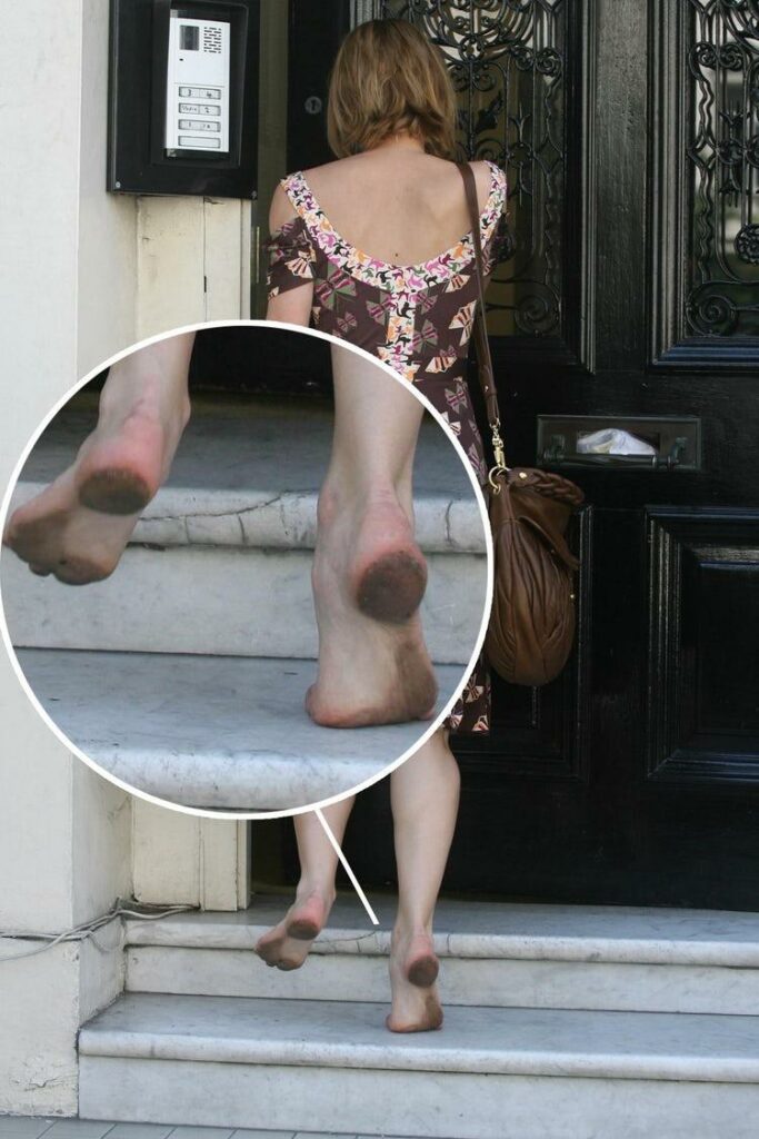 Keira Knightleys Dirty Feet