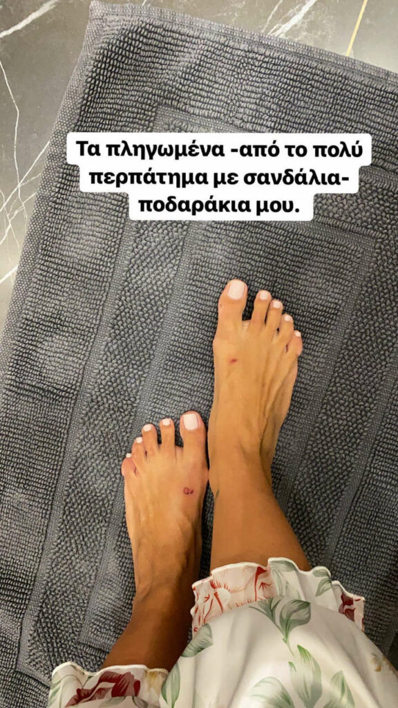 Nancy Paradeisanou Feet (6 pictures)
