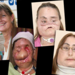 Here’s Everything You Need to Know About Why Is Charla Nash’s Face So Different