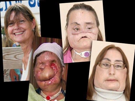 Here’s Everything You Need to Know About Why Is Charla Nash’s Face So Different