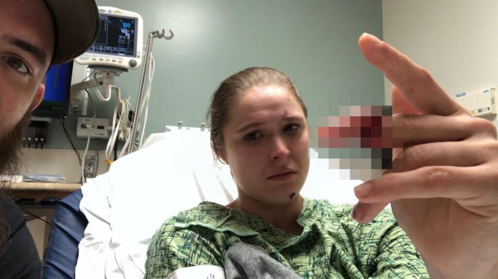 Ronda Rousey accident