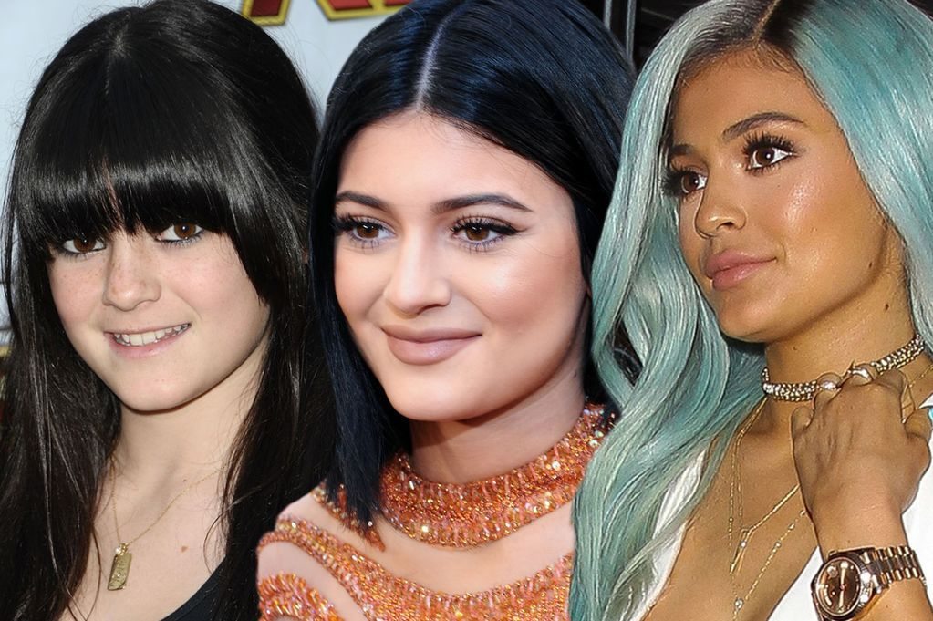 Kylie Jenners nose