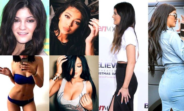 kylie jenner plastic surgery top doctor estimates boob job face work