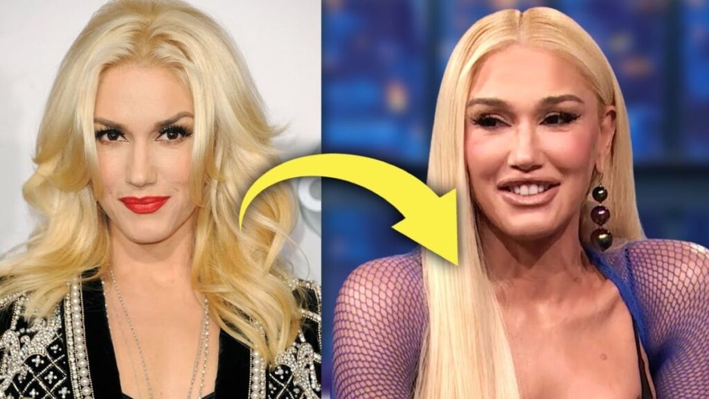 Gwen Stefani: Gracefully Defying Time Amidst Plastic Surgery Speculations