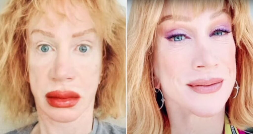 Kathy Griffin Lip Tattoo Sparks Debate Some Fans Think It’s a Bad Idea
