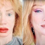 Kathy Griffin lip tattoo procedure goes awry leaving her lips swollen and bruised.